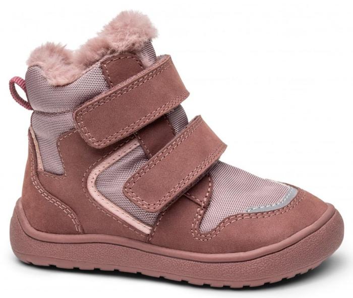 Protetika Daxi Old Pink náhled
