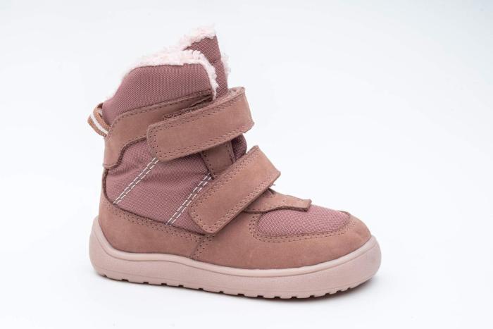 Protetika Lora Old Pink náhled